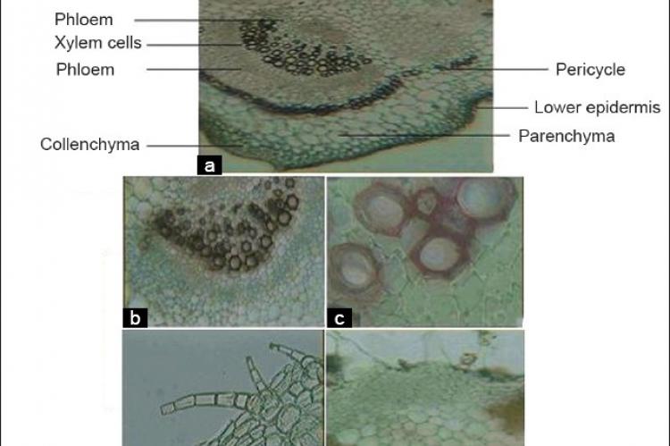 (a–e) Photographs of transverse sections of Trichosanthes dioica leaf, (a) Tranverse section showing Bicollateral vascular bundle (×4) of T. dioica leaves (b) Lignified Xylem and Phloem cells (×10),(c) Lignified xylem cells (×40), (d) Multicellular covering trichomes (×10), (e) Glandular trichomes (×10)