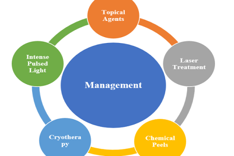Management of Freckles